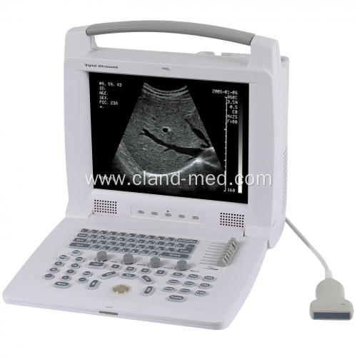 Portable Laptop Ultrasound Scanner Ultrasound Machine Price